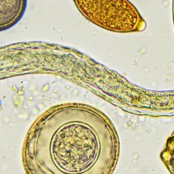 Image result for Tips for Parasite Prevention